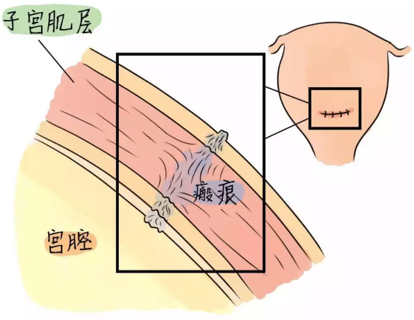 重慶送子鳥醫(yī)院