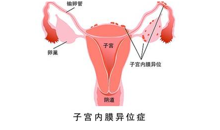 重慶送子鳥醫(yī)院