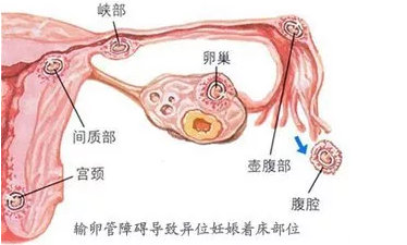 重慶送子鳥(niǎo)醫(yī)院